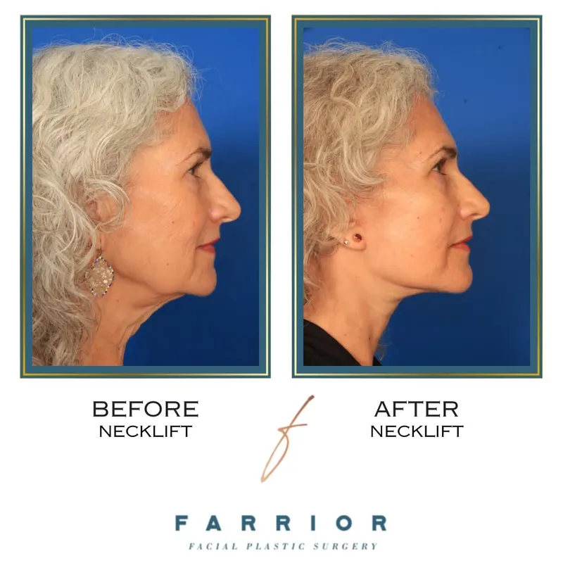 Before and after — Dr. Edward Farrior