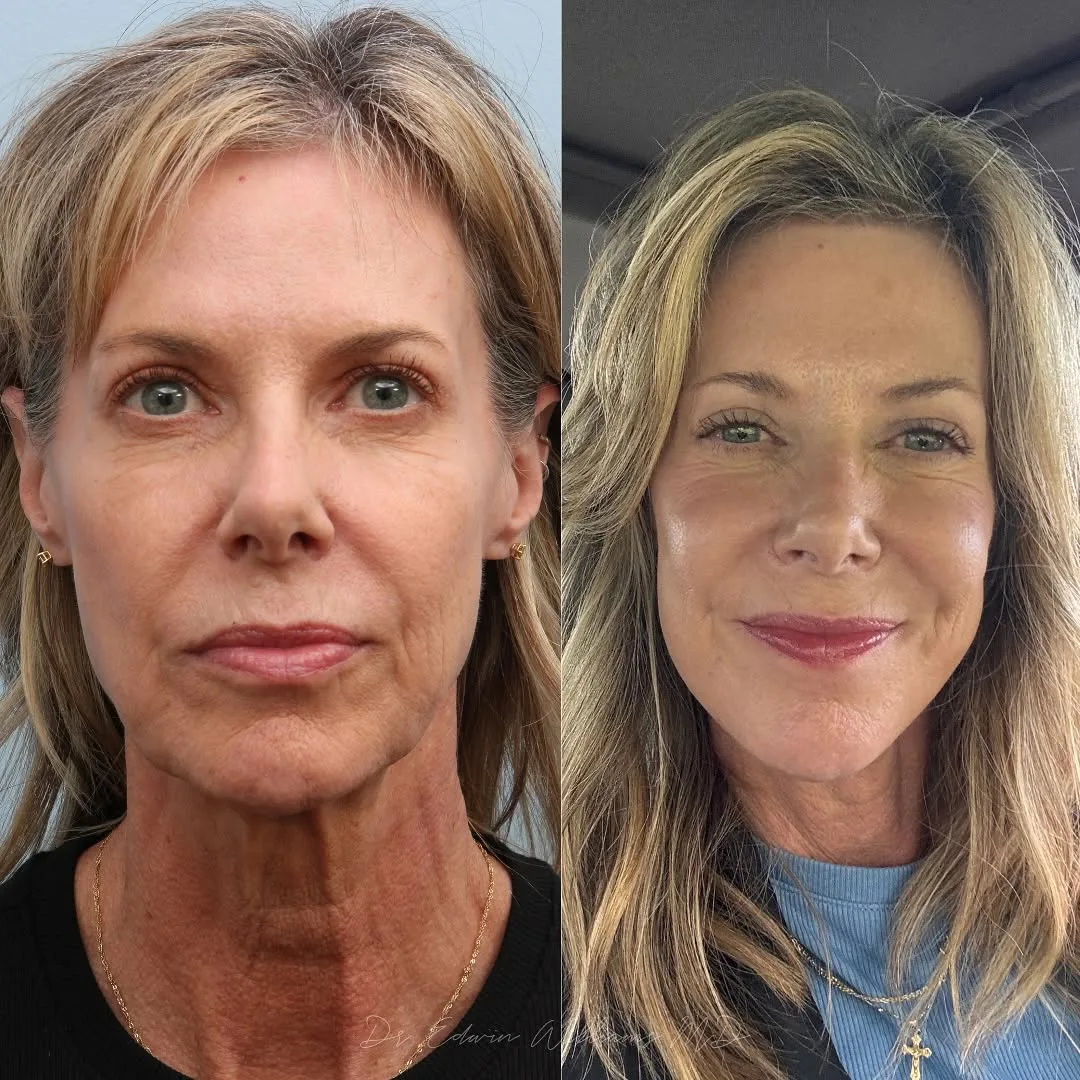 Before and after — Dr. Edwin Williams