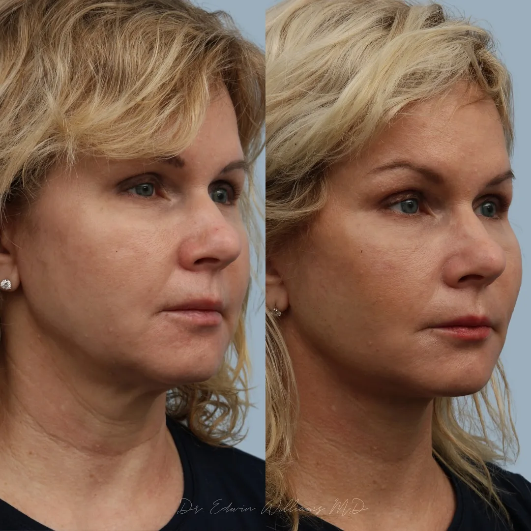 Before and after — Dr. Edwin Williams
