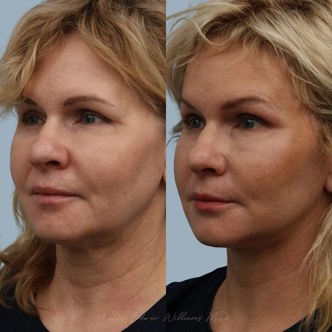 Before and after — Dr. Edwin Williams