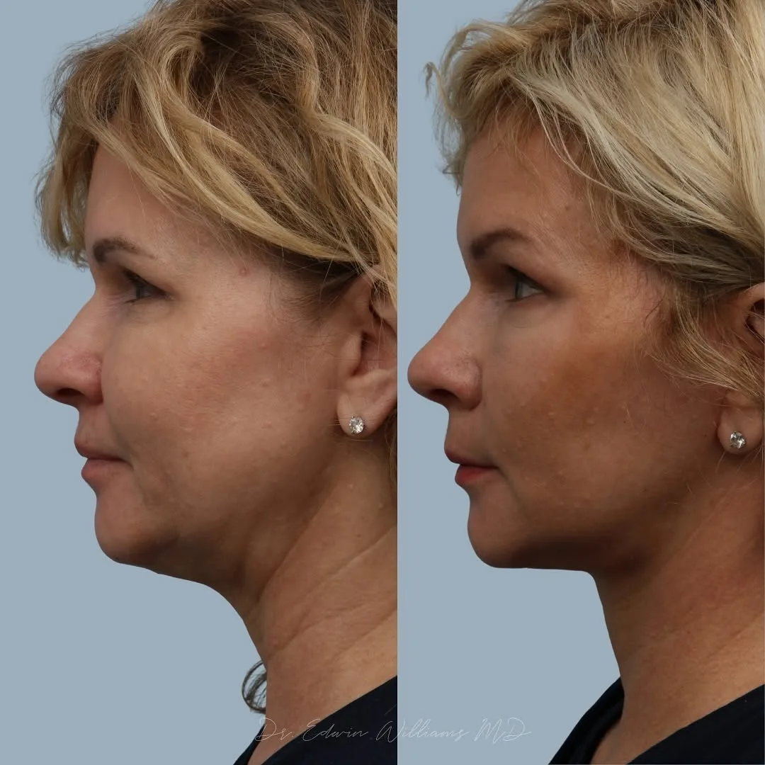 Before and after — Dr. Edwin Williams
