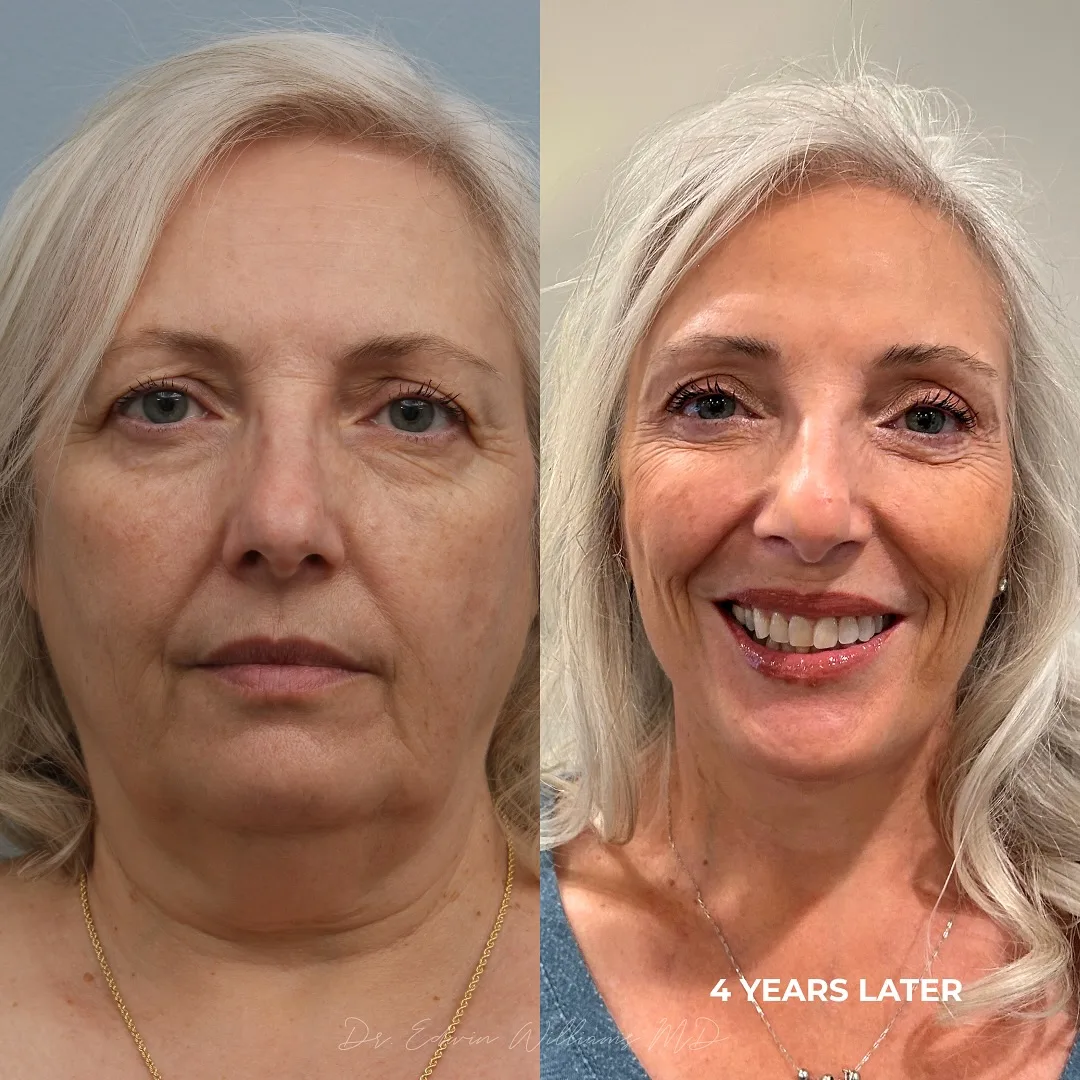Before and after — Dr. Edwin Williams