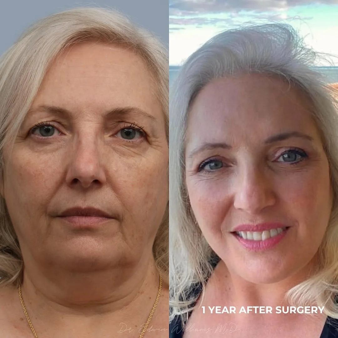 Before and after — Dr. Edwin Williams