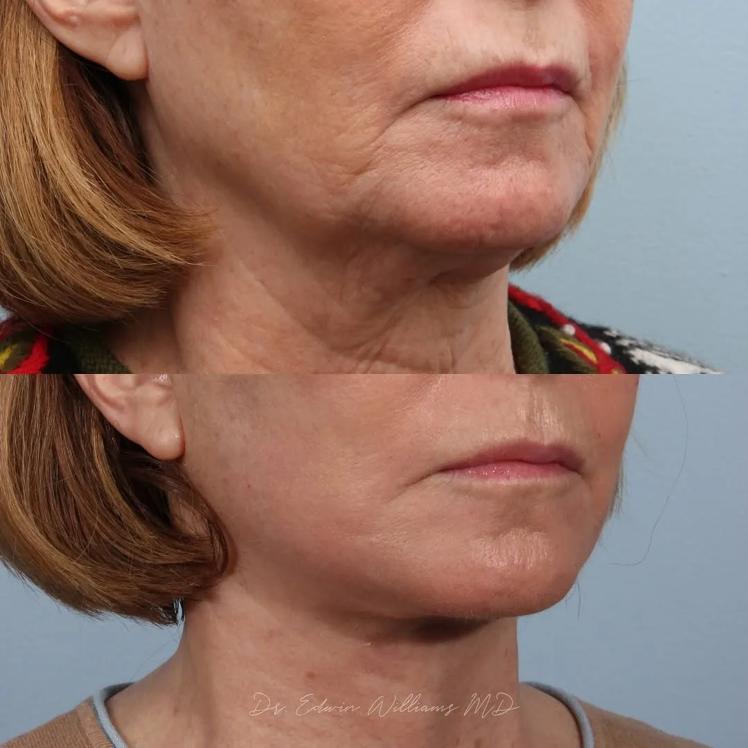 Before and after — Dr. Edwin Williams