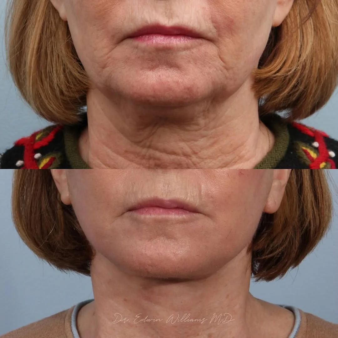 Before and after — Dr. Edwin Williams