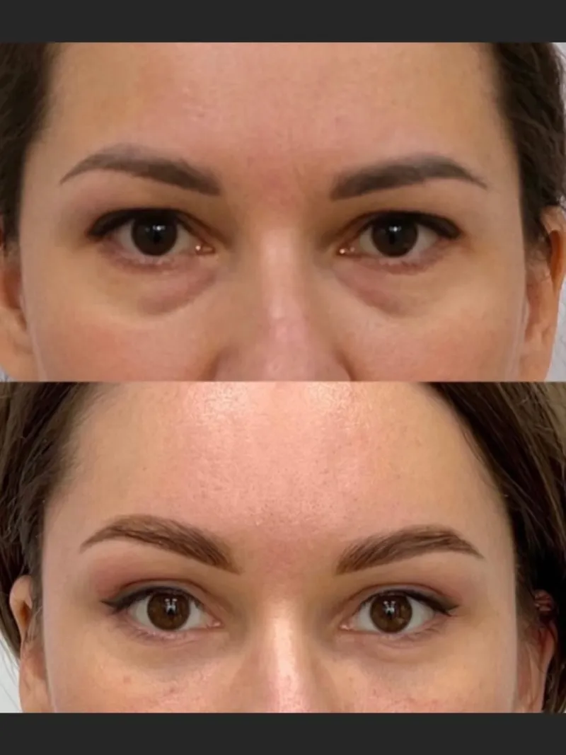 Before and after: Dr. Elena Pozdnikina