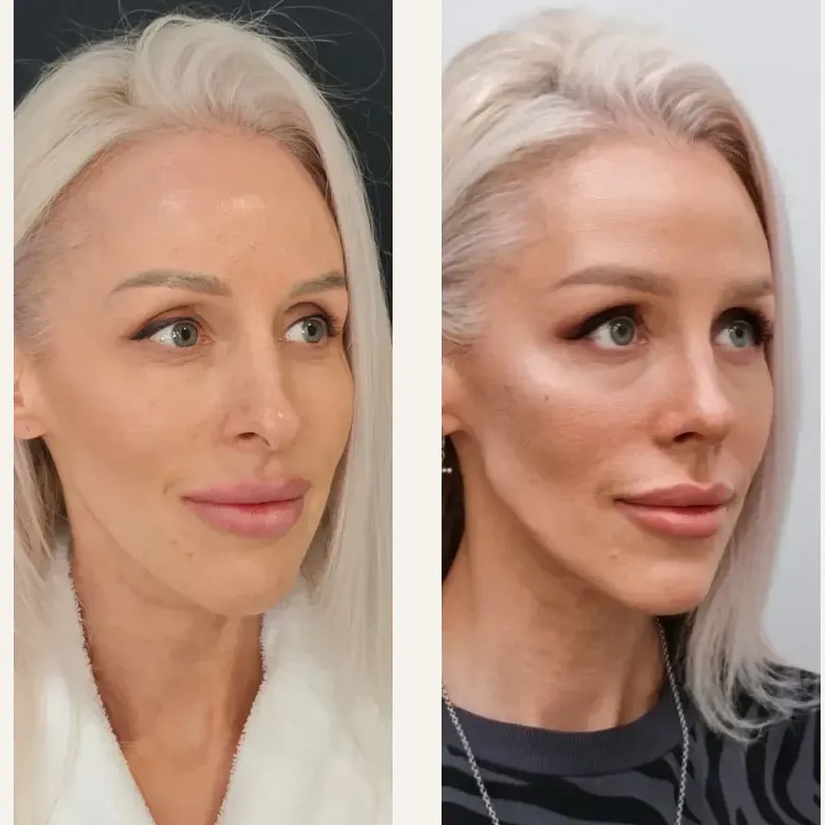 Before and after: Dr. Elena Pozdnikina
