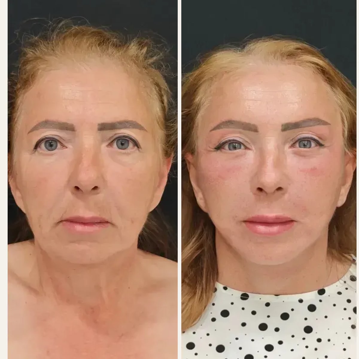 Before and after: Dr. Elena Pozdnikina