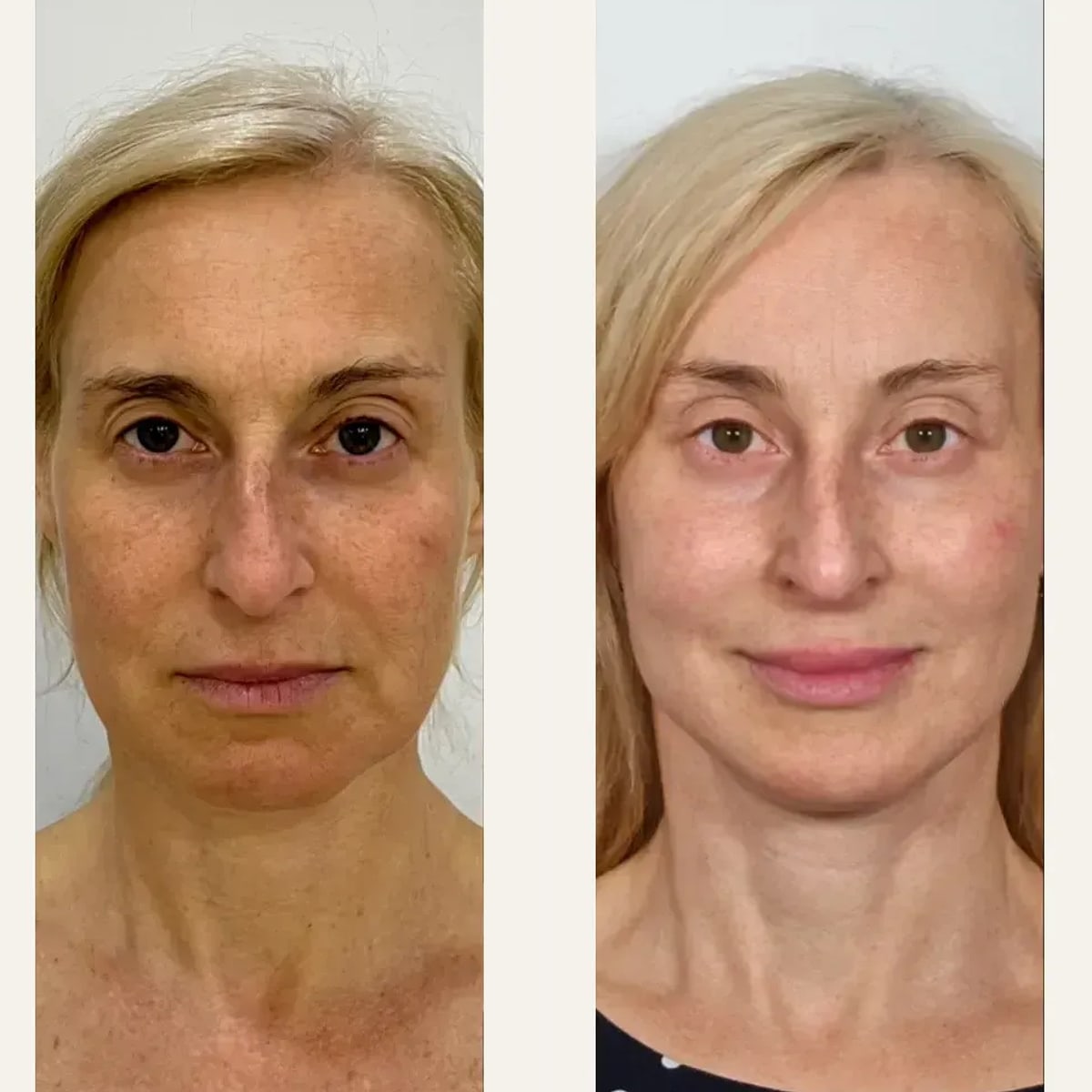 Before and after: Dr. Elena Pozdnikina