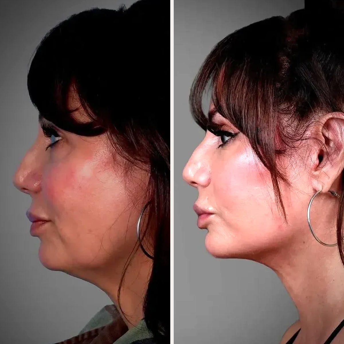 Before and after: Dr. Erin Smith