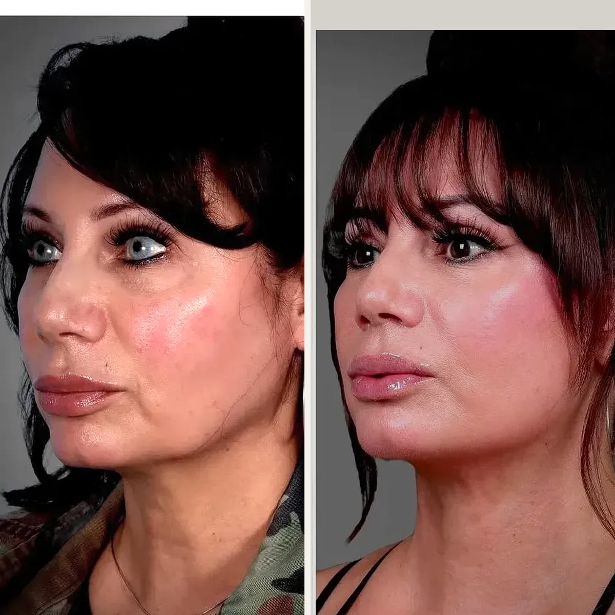 Before and after: Dr. Erin Smith