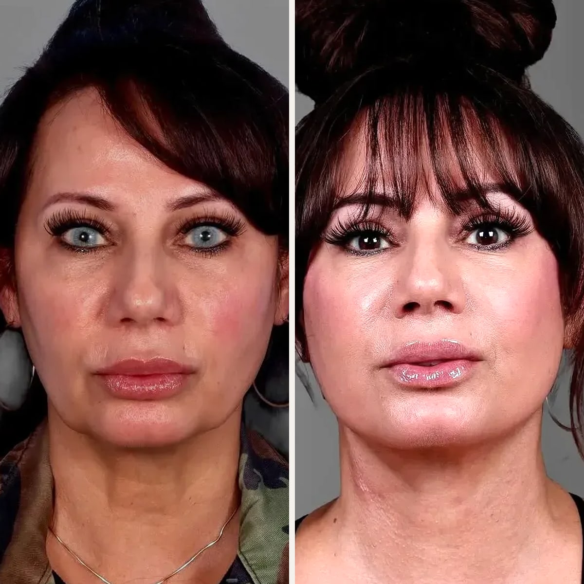 Before and after: Dr. Erin Smith