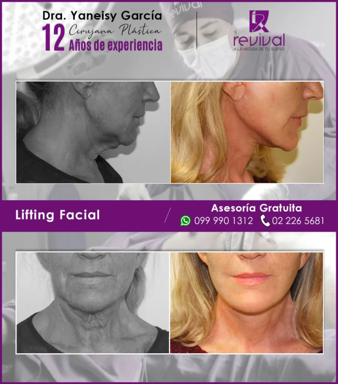 Before and after: Dr. Evelyn Lisseth Alvarracin Vinueza