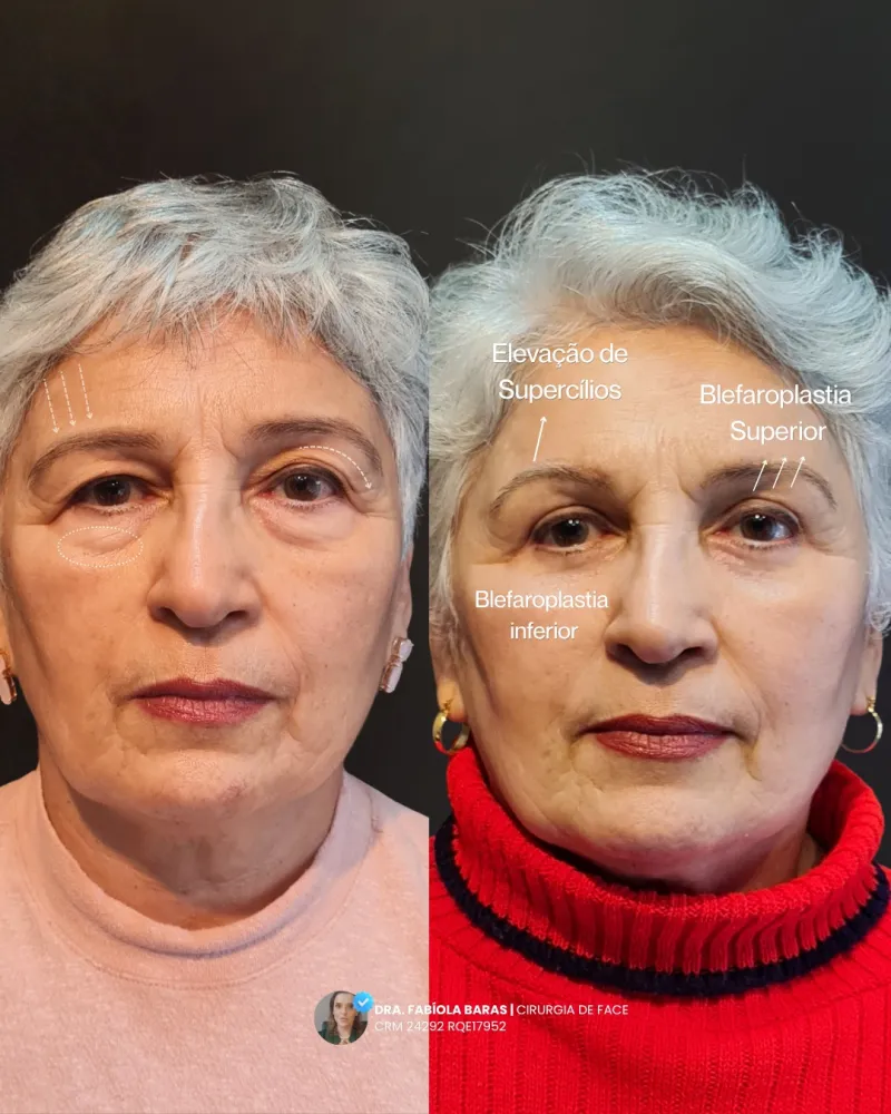 Before and after: Dr. Fabíola Baras