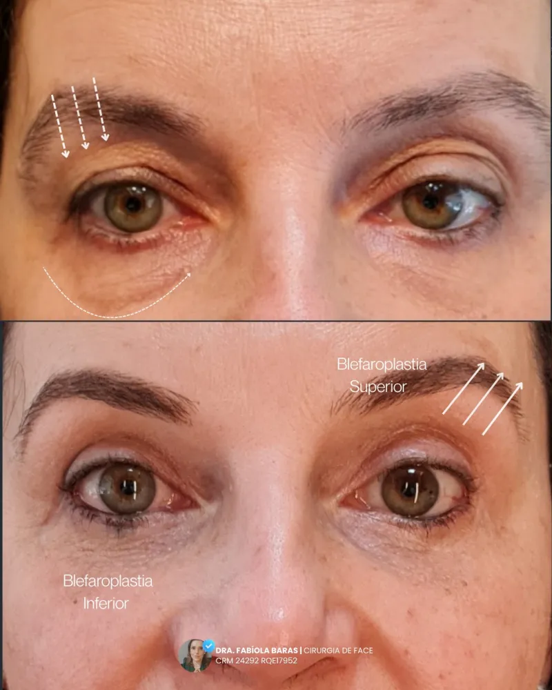 Before and after: Dr. Fabíola Baras