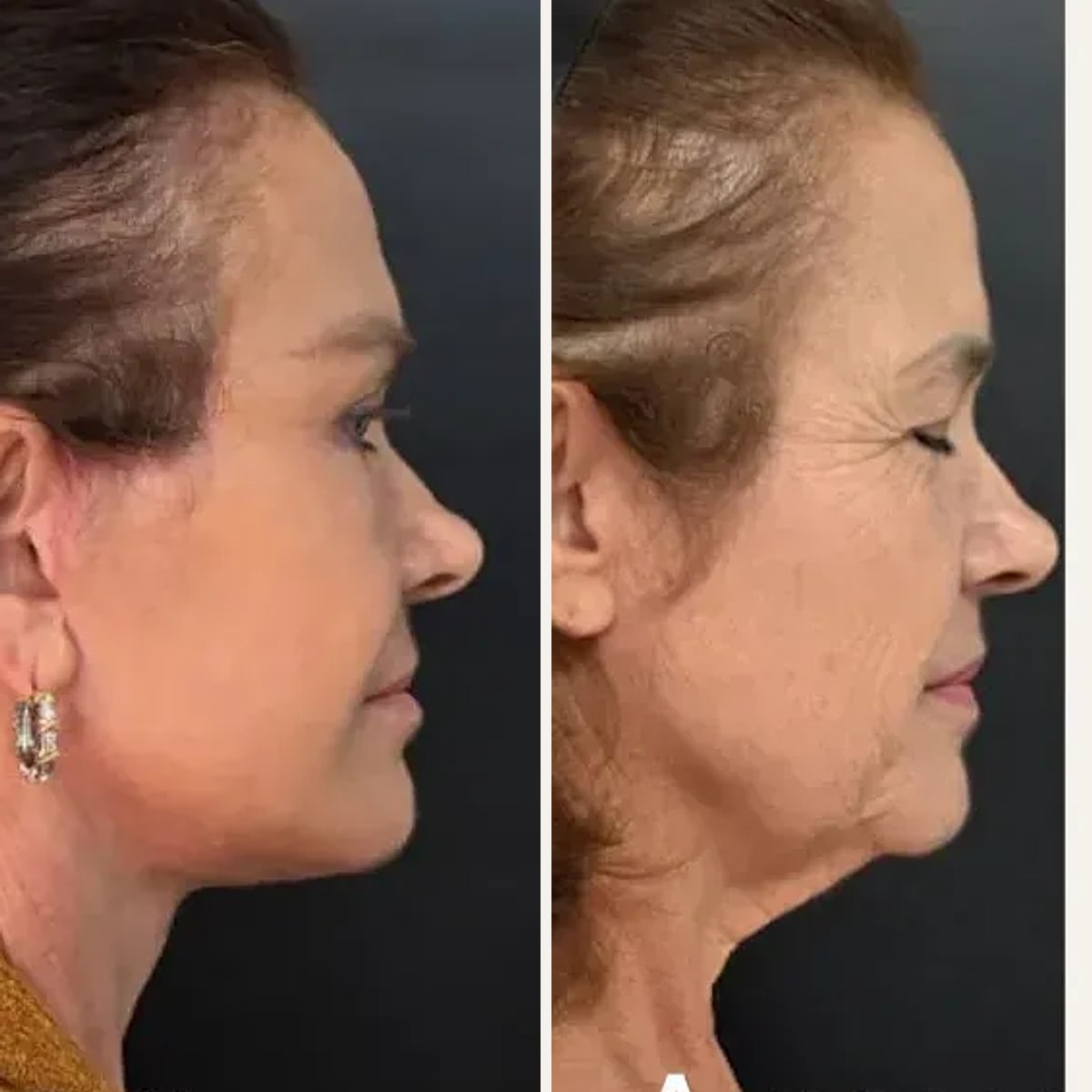 Before and after: Dr. Fabíola Baras