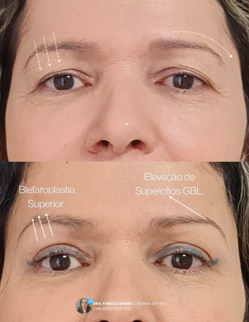 Before and after: Dr. Fabíola Baras