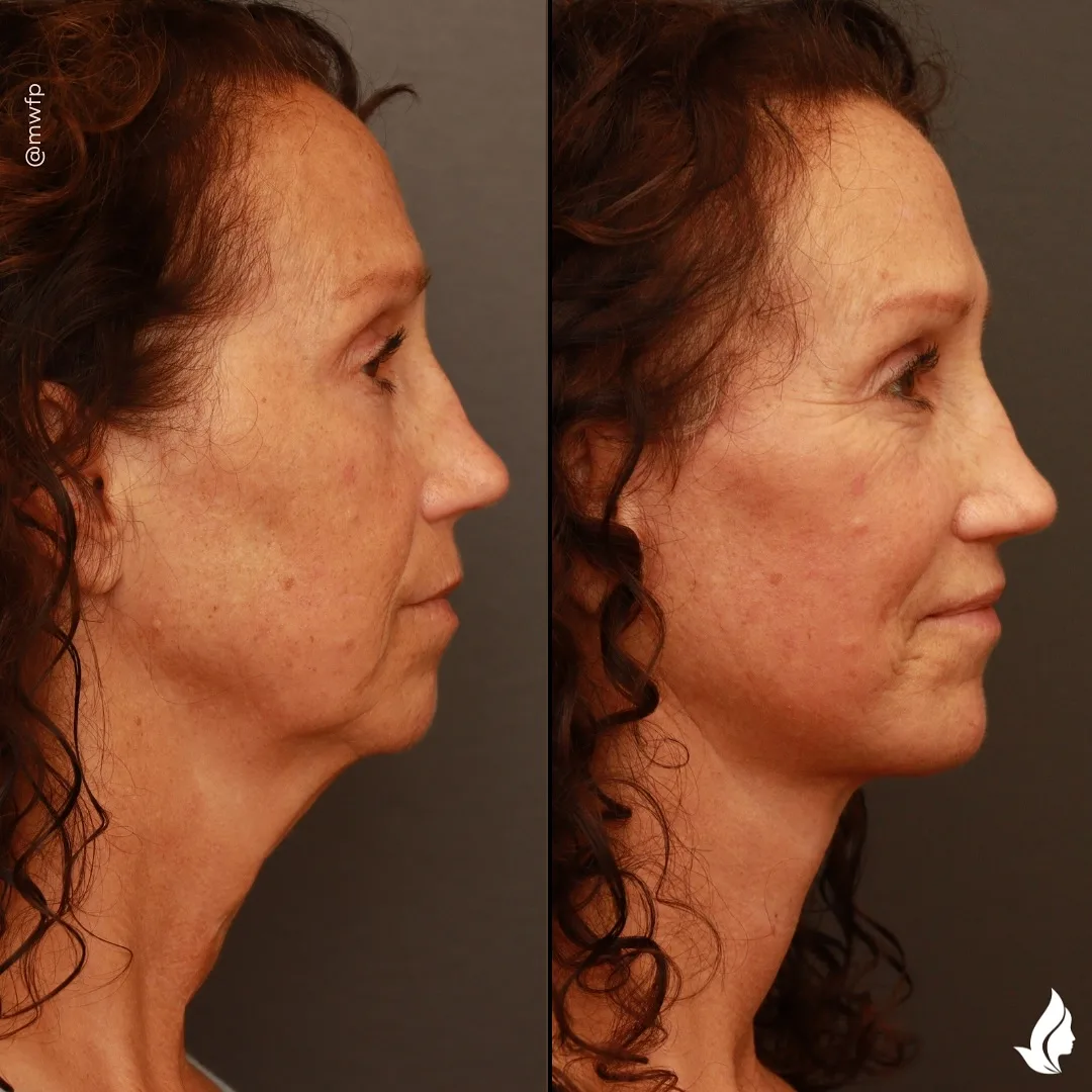 Before and after — Dr. Zachary Farhood