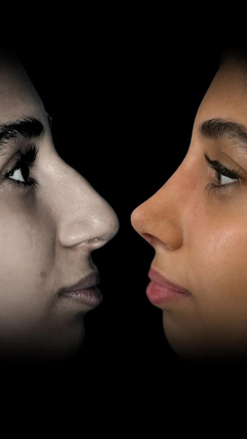 Before and after — Dr. Farzin Davoudi