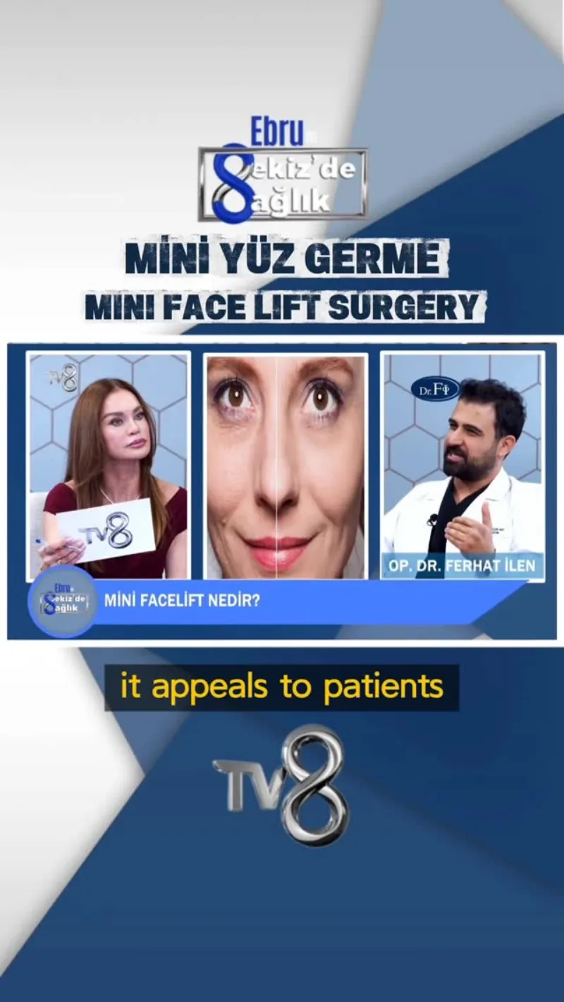 Before and after — Dr. Ferhat İlen