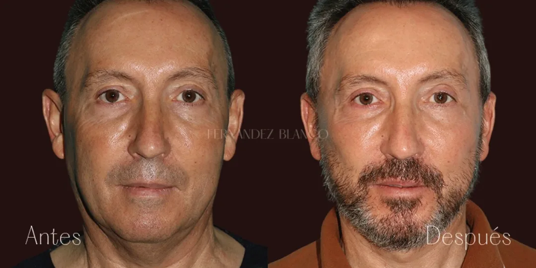 Before and after — Dr. Fernández Blanco