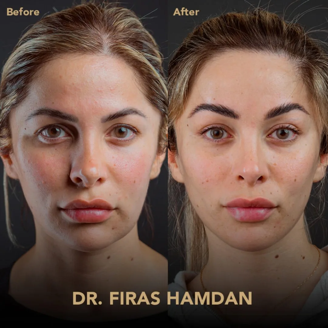 Before and after: Dr. Firas Hamdan