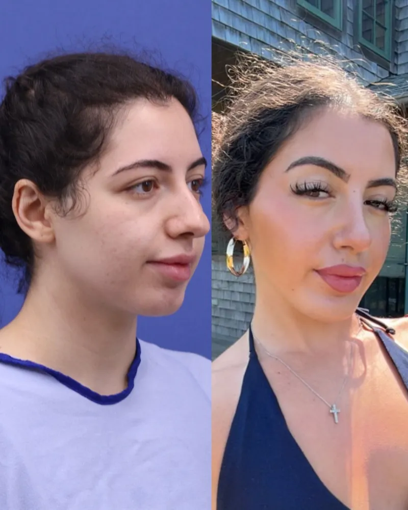 Before and after — Dr. Frank Fechner