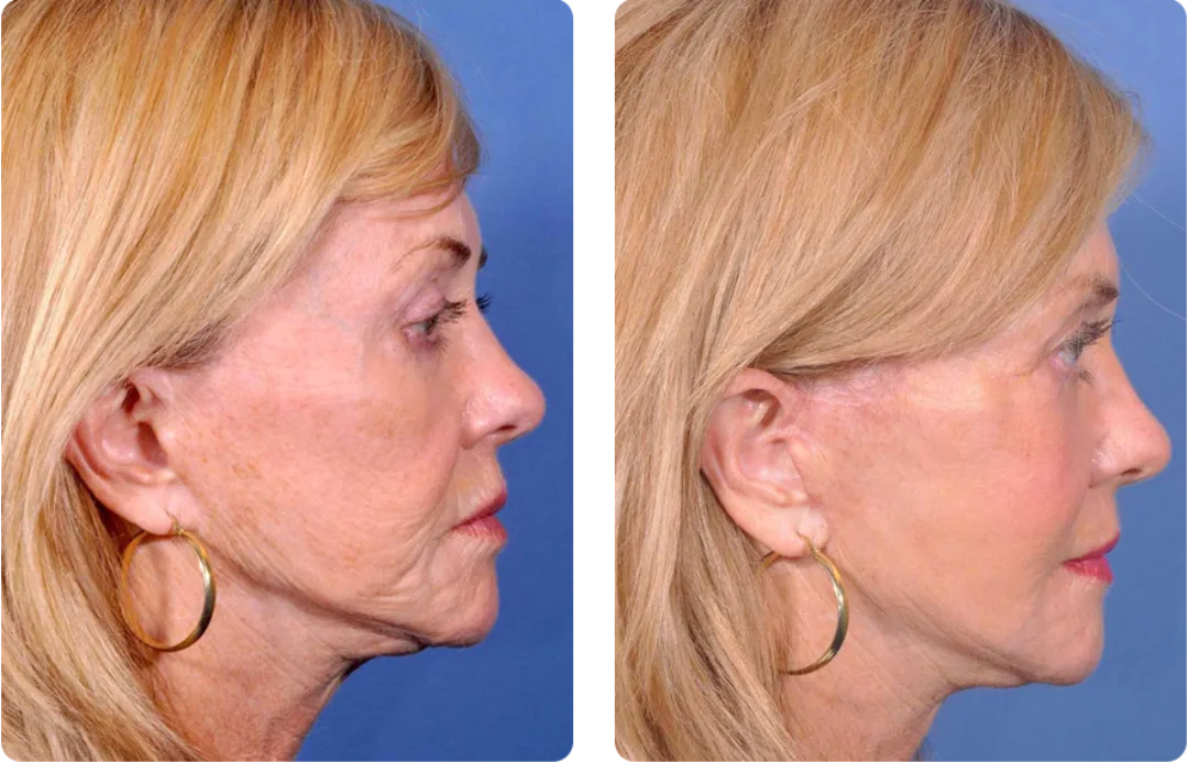 Before and after — Dr. Fred Fedok