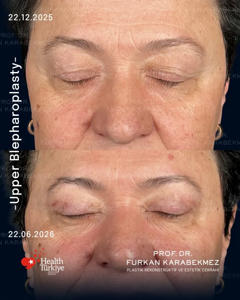 Before and after — Prof. Furkan Karabekmez