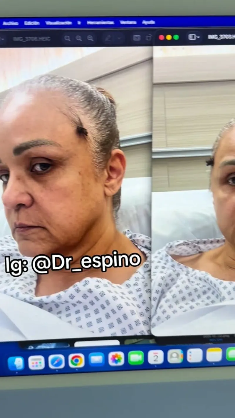 Before and after — Dr. Gabriel Espino