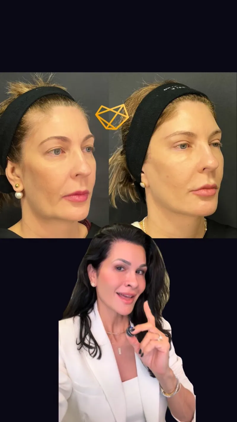 Before and after: Dr. Gabriela Schwartzmann
