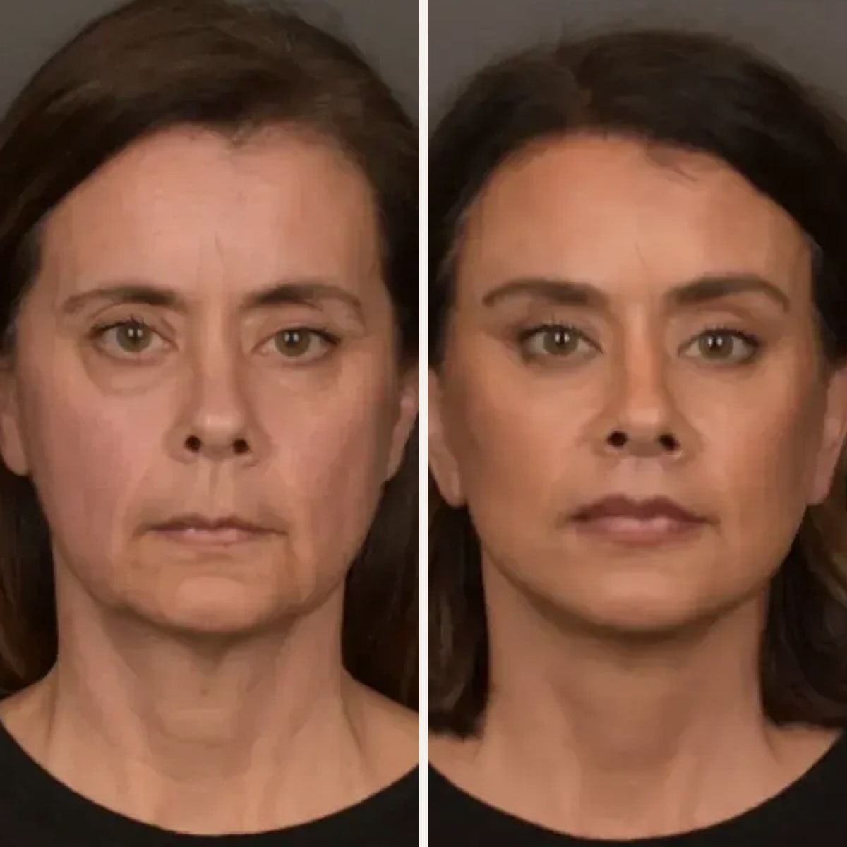 Before and after: Dr. Gabriele Miotto