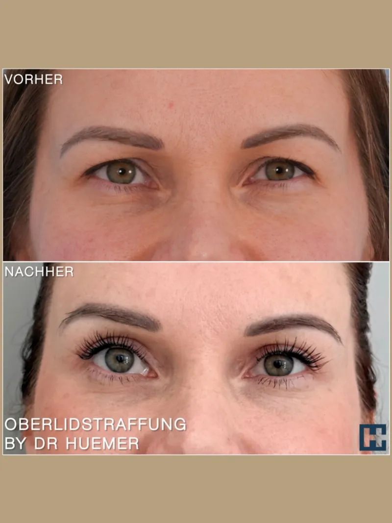 Before and after: Dr. Georg Huemer