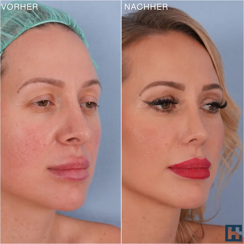 Before and after: Dr. Georg Huemer