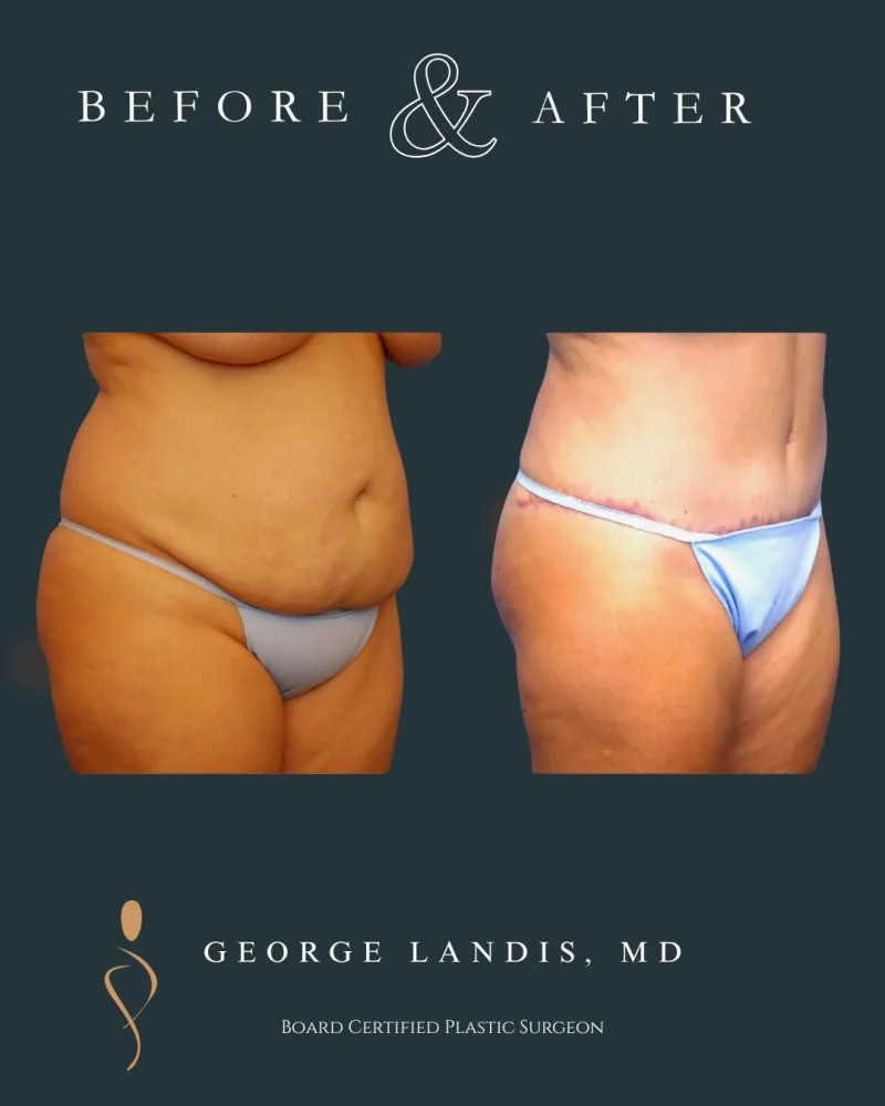Before and after — Dr. George Landis