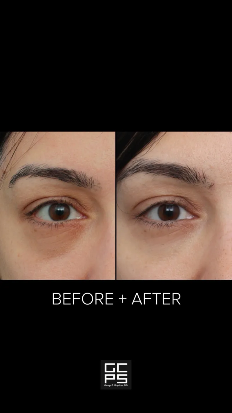 Before and after: Dr. George Moynihan