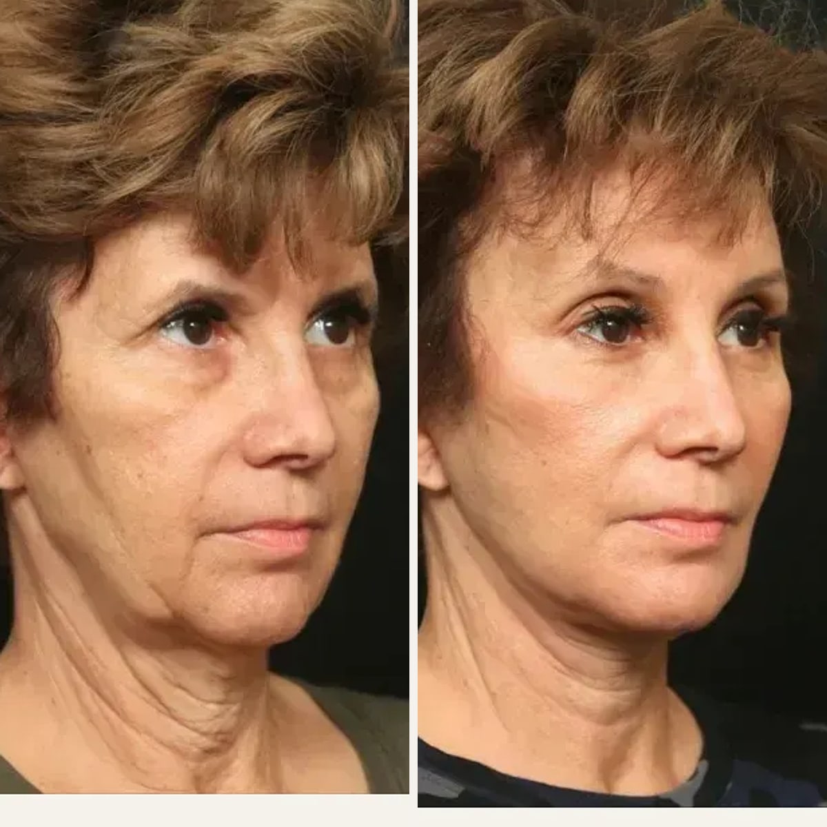 Before and after: Dr. George Toledo
