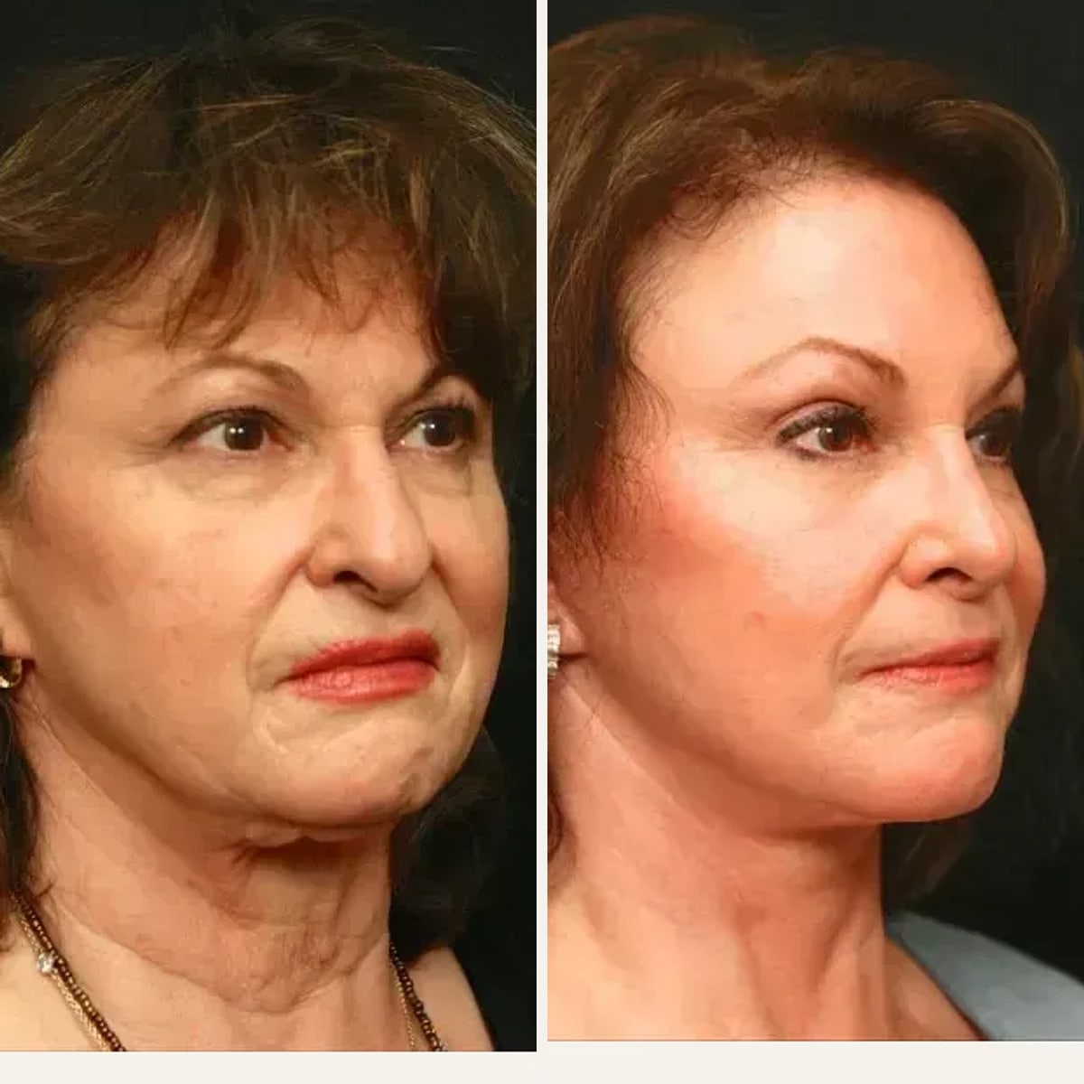 Before and after: Dr. George Toledo