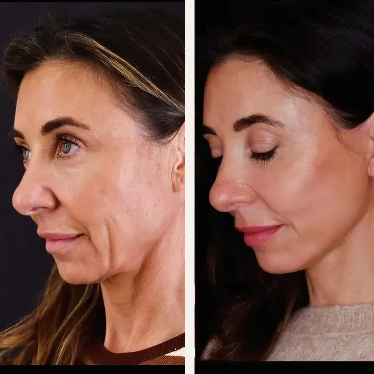 Before and after: Dr. Georgios Orfaniotis