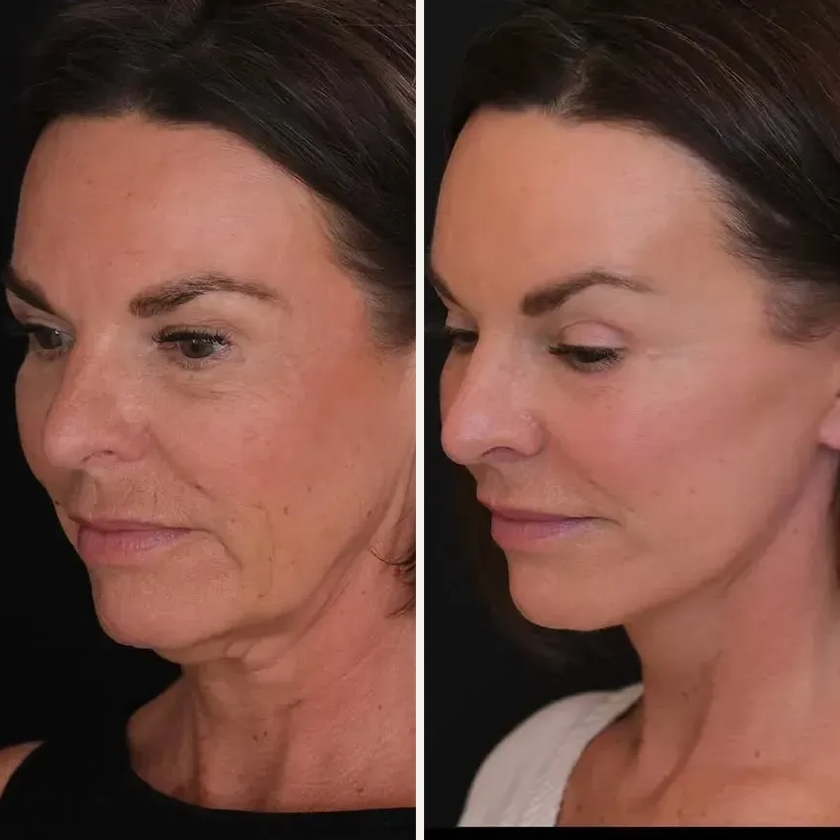 Before and after: Dr. Georgios Orfaniotis