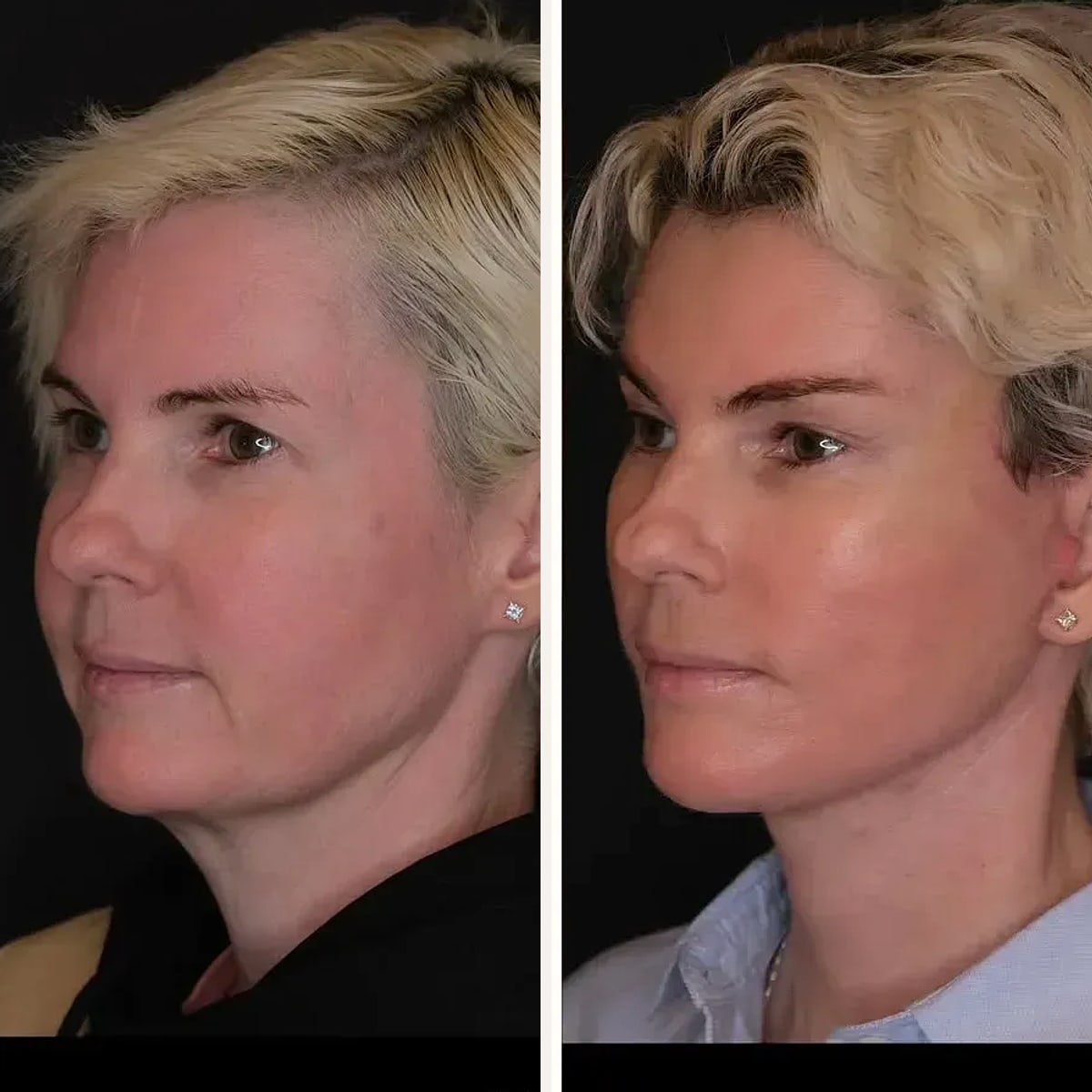 Before and after: Dr. Georgios Orfaniotis