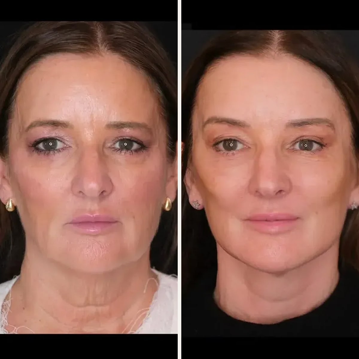 Before and after: Dr. Georgios Orfaniotis