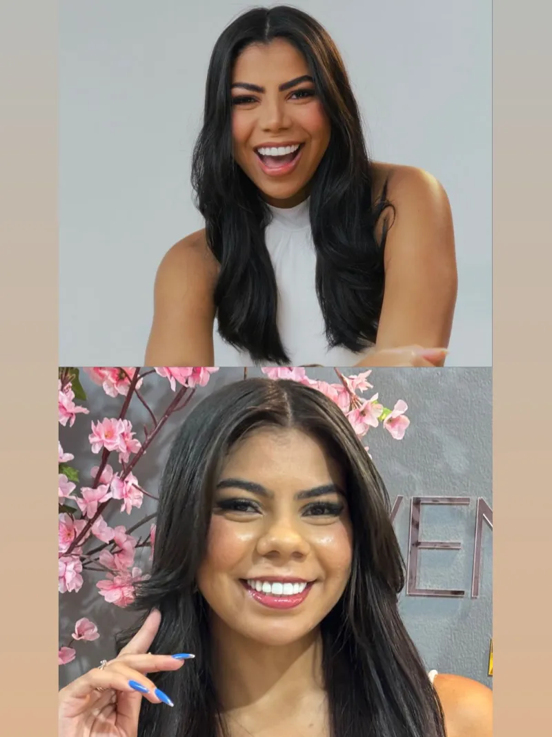 Before and after — Dr. Gilson Guedes Neto