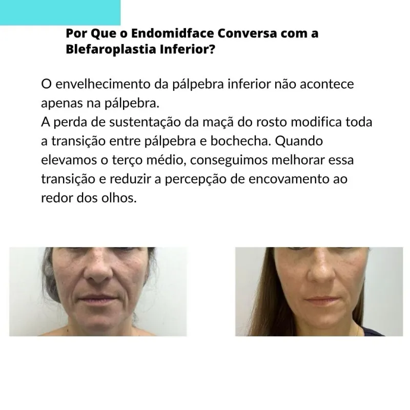 Before and after: Dr. Glayse June Sasaki Acacio Favarin