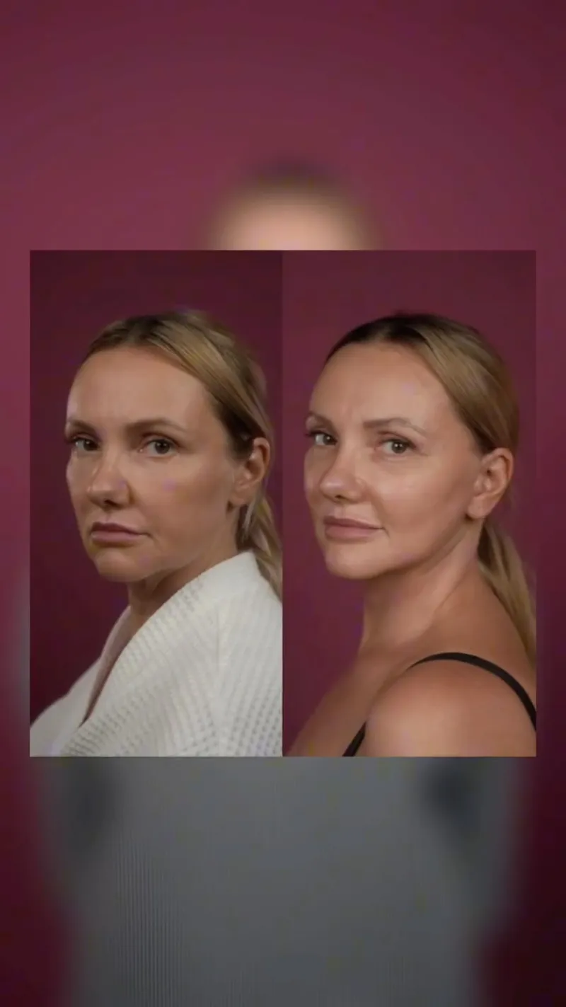 Before and after — Dr. Gleb Tumakov
