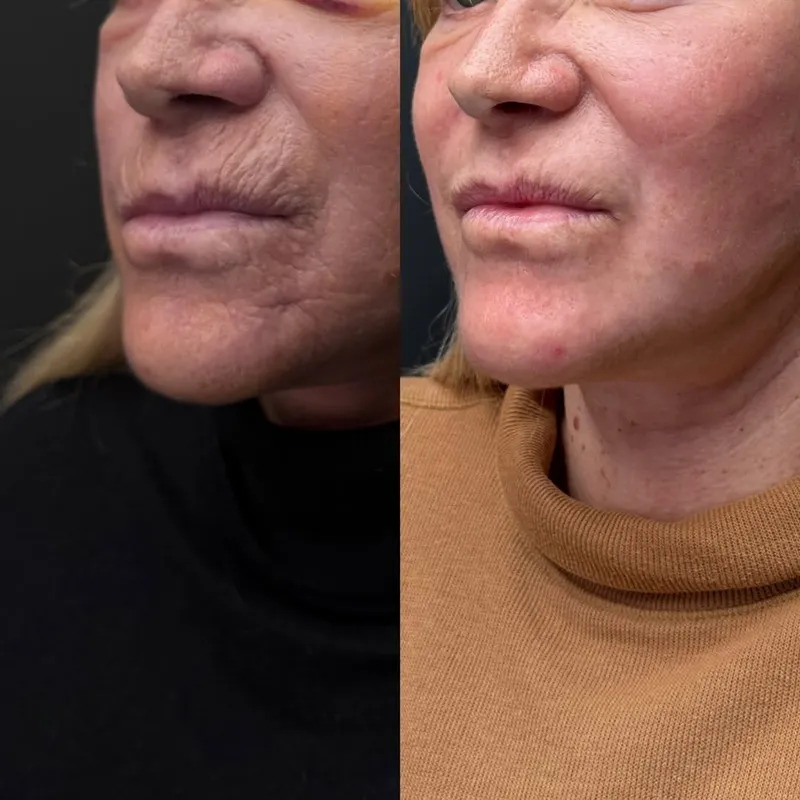 Before and after — Dr. Gloria Marchese