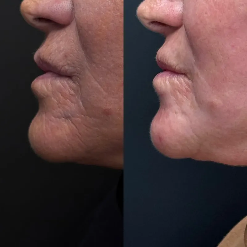 Before and after — Dr. Gloria Marchese