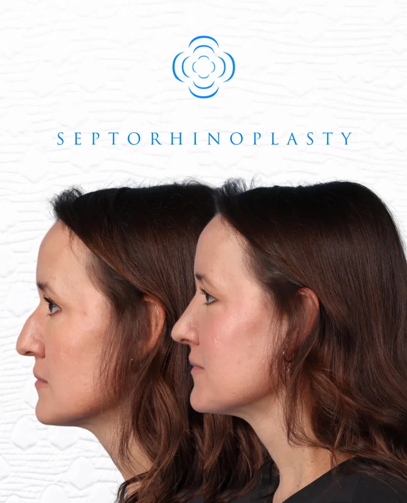 Before and after — Dr. Grady Core