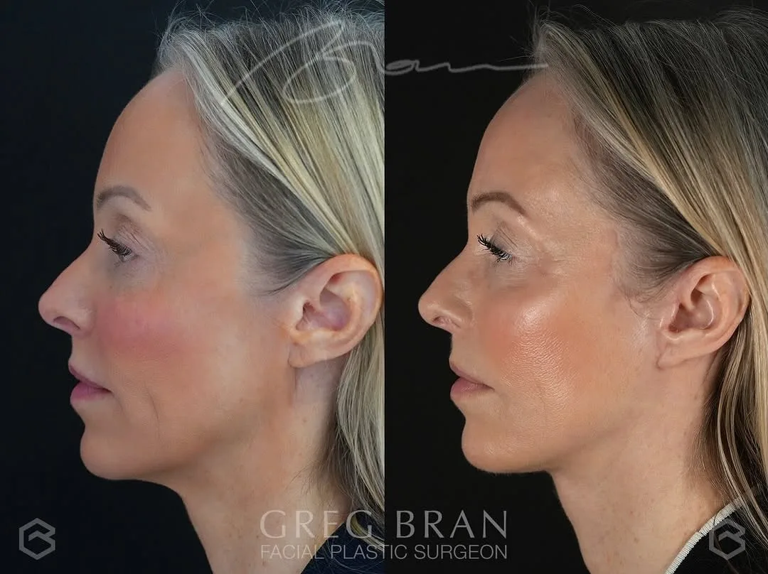 Before and after — Dr. Greg Bran