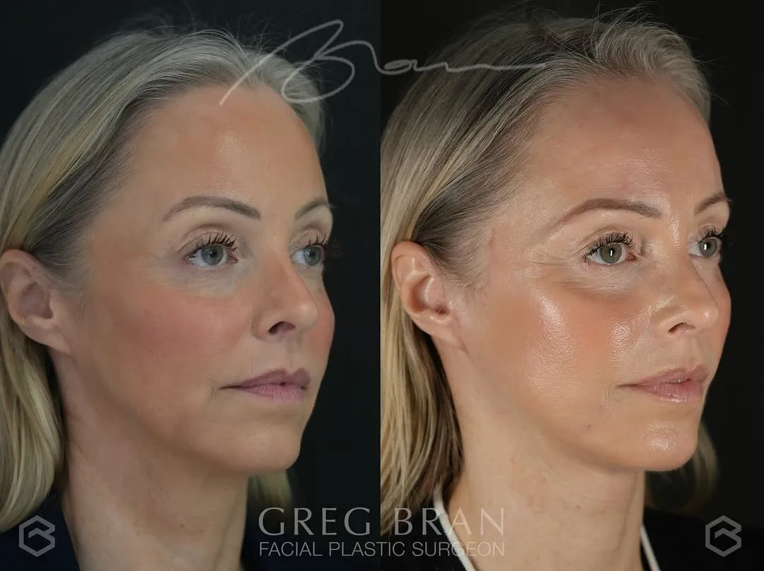 Before and after — Dr. Greg Bran